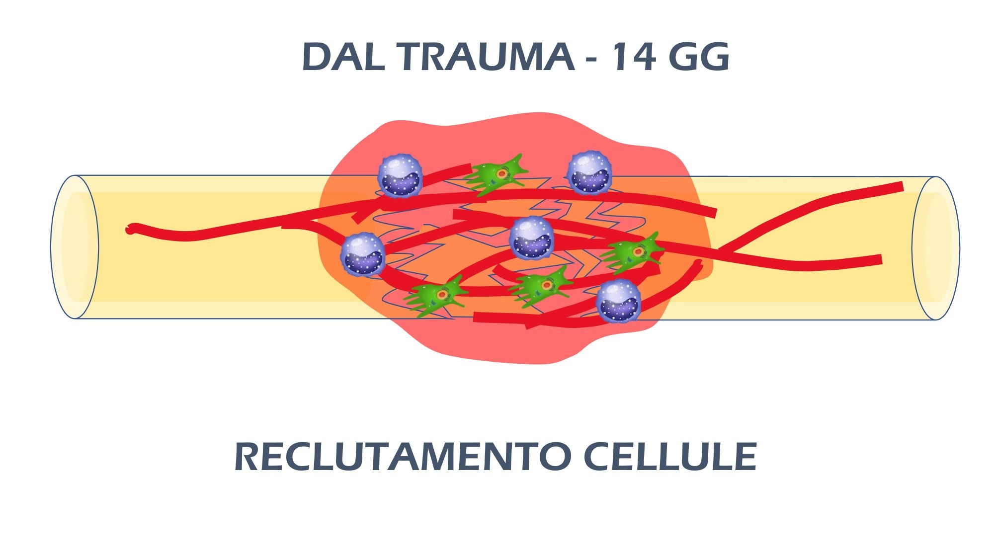 La guarigione delle fratture